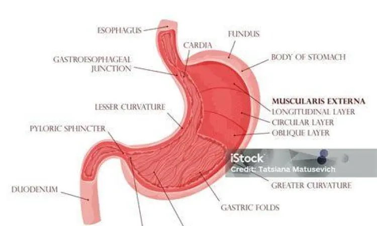 Diagram lokasi sakit perut dan penyebabnya