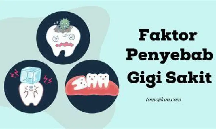 Ilustrasi anatomi gigi yang mengalami karies hingga ke pulpa