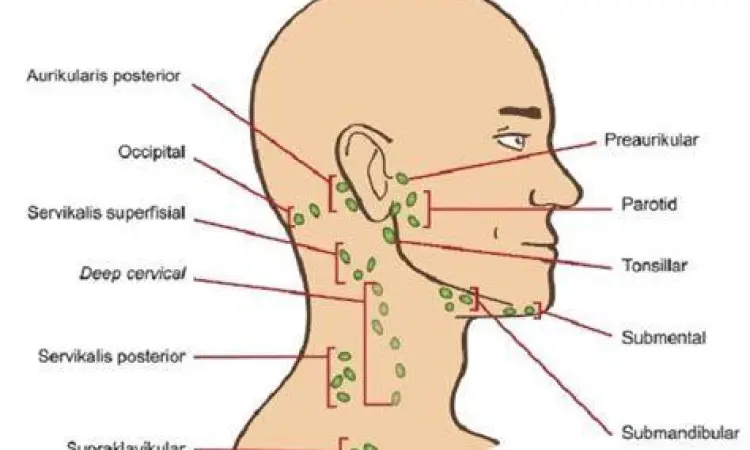 Prosedur biopsi jarum halus pada kelenjar getah bening