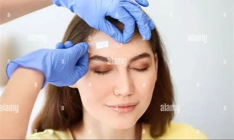 Cara Pakai Bye Bye Fever Cara menempelkan plester kompres demam di dahi