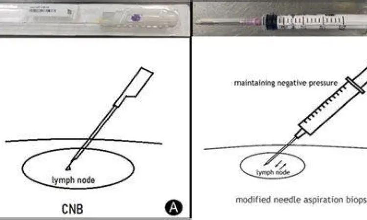 prosedur biopsi jarum halus pada leher