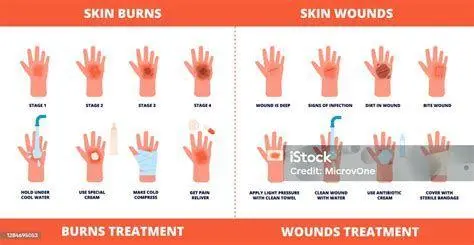 Proses Penyembuhan Luka Proses penyembuhan kulit setelah penggunaan salep