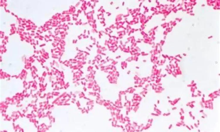 Bakteri Escherichia coli Mikroskopis bakteri E. coli penyebab utama infeksi saluran kemih