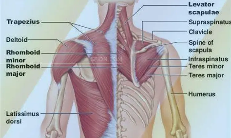 Ilustrasi titik nyeri pada pinggang manusia