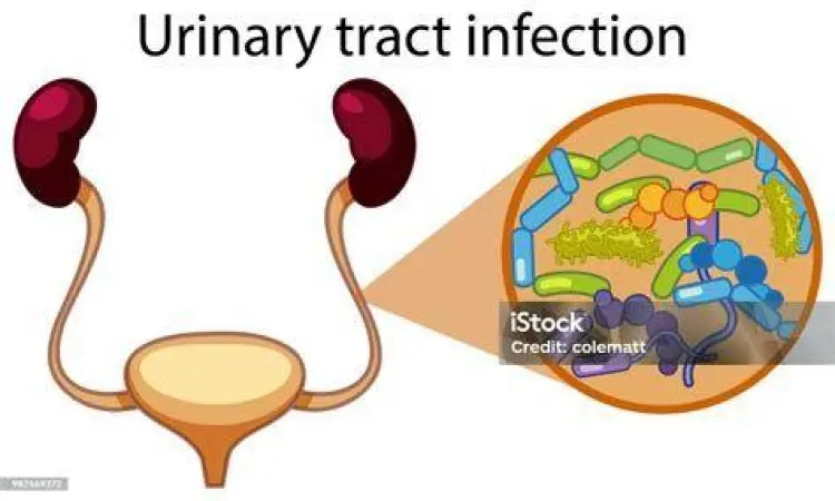 Penyebab Anyang Anyangan Ilustrasi infeksi saluran kemih yang menyebabkan anyang-anyangan