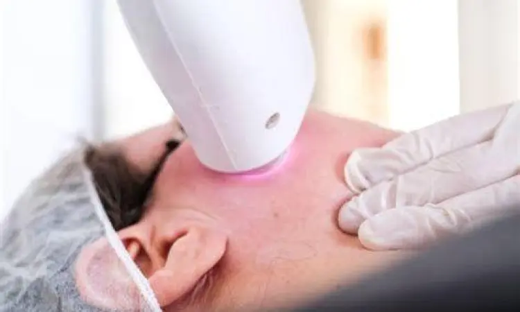 Terapi Laser Kulit Prosedur laser wajah oleh tenaga medis profesional