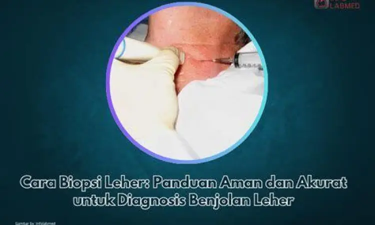 Prosedur FNAB Leher Ilustrasi prosedur biopsi jarum halus pada leher