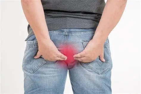 Jenis Gejala Ambeien Perbedaan ambeien dalam dan luar