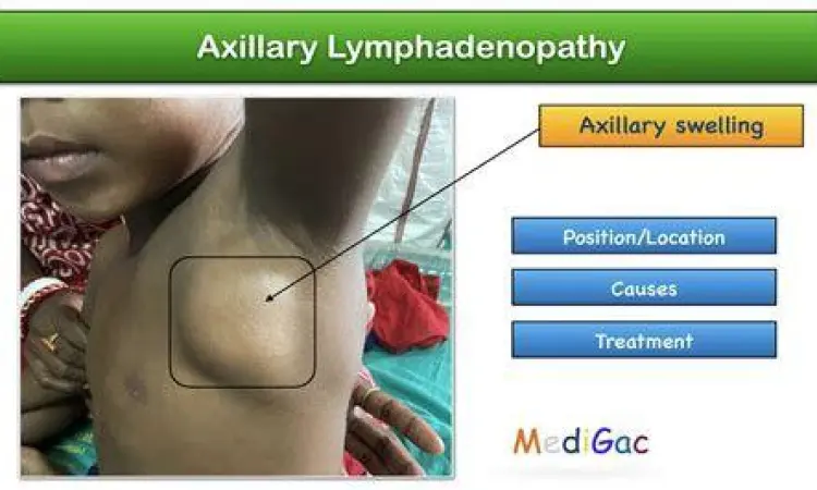 Dokter sedang menjelaskan hasil diagnosis benjolan kepada pasien