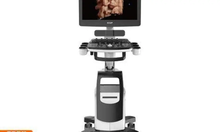 Tampilan layar USG 4D memperlihatkan wajah janin