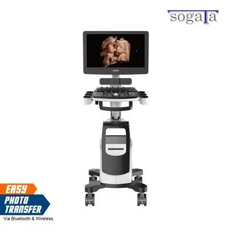 Teknologi USG 4D Tampilan layar USG 4D memperlihatkan wajah janin