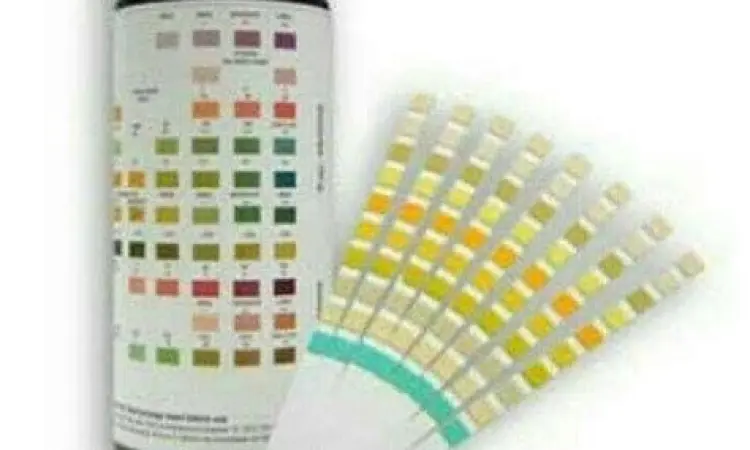Multi-Parameter Urine Test Alat tes urin multi parameter untuk NAPZA