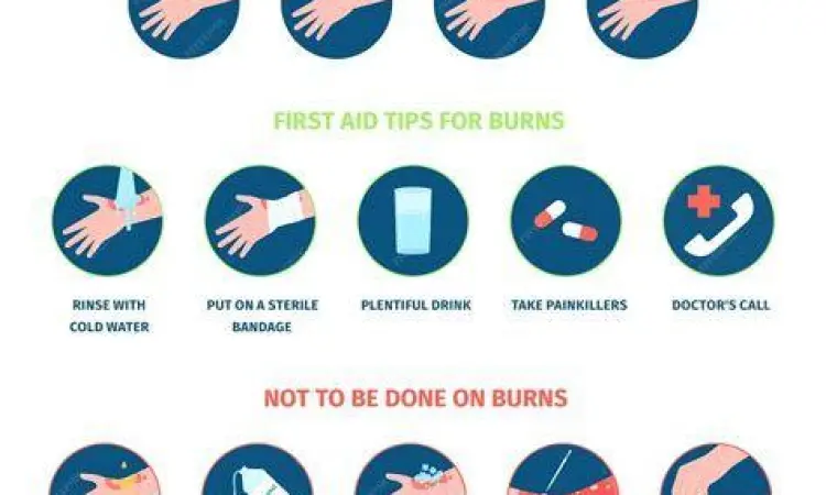 Pertolongan Pertama Luka Bakar Langkah benar pertolongan pertama pada luka bakar