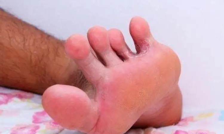 Seorang pria sedang mengeringkan kaki dengan handuk bersih