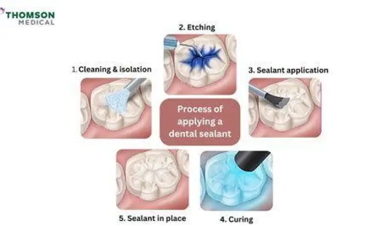 Langkah penggunaan Cooling 5 Plus yang benar