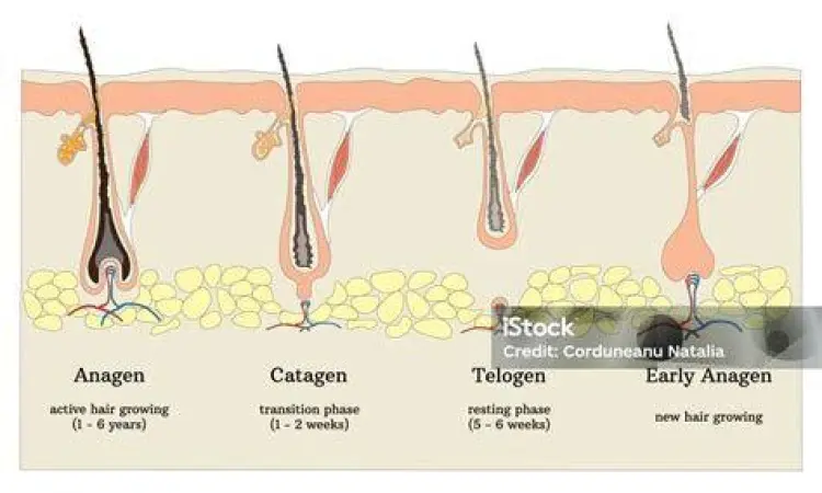 Diagram siklus pertumbuhan rambut anagen katagen telogen