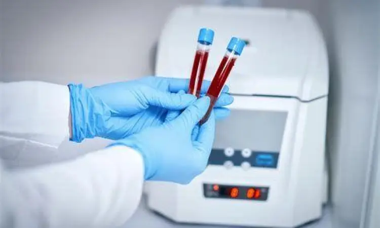 Pemeriksaan darah laboratorium untuk cek trombosit