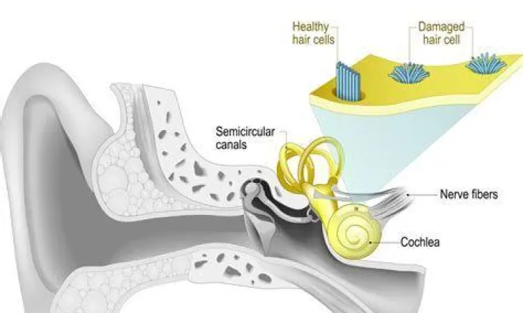 Anatomi telinga manusia yang mengalami tinnitus