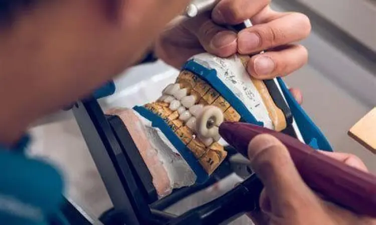 Teknisi sedang mengerjakan detail gigi tiruan