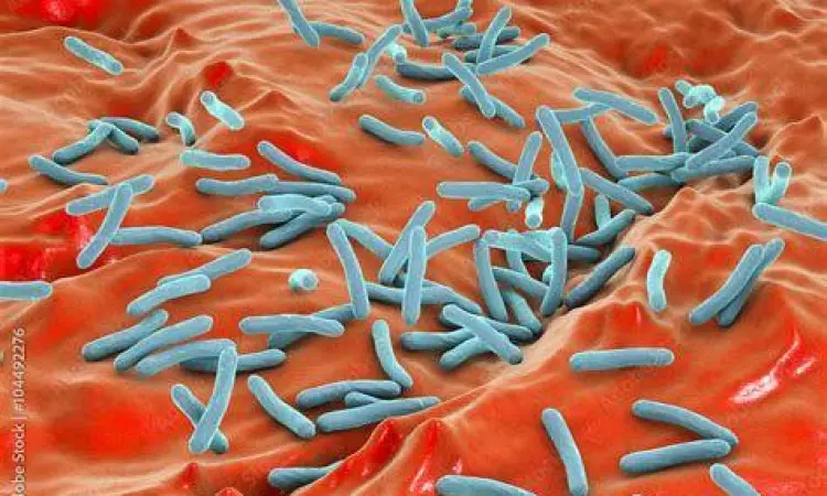 Mikroskopis Bakteri TBC Tampilan mikroskopis bakteri penyebab TBC