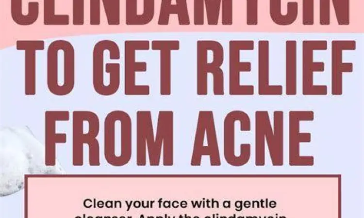 Clindamycin Topical Penggunaan clindamycin gel untuk jerawat