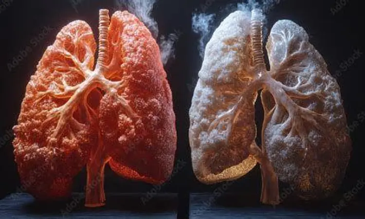 Perbandingan paru-paru sehat dan paru-paru perokok