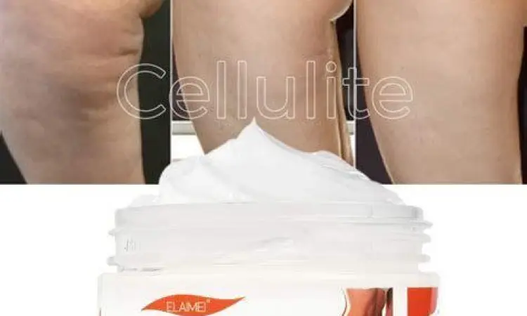 Hasil Penggunaan Krim Ilustrasi hasil penggunaan krim pembakar lemak