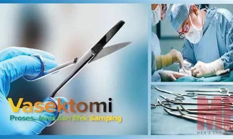 Prosedur Medis Vasektomi Visualisasi medis prosedur vasektomi pada saluran vas deferens