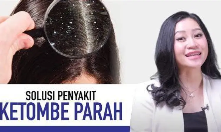 Kondisi kulit kepala berketombe