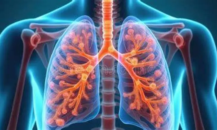 Anatomi paru-paru yang mengalami infeksi