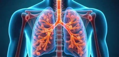 Kondisi Paru Paru Terinfeksi Anatomi paru-paru yang mengalami infeksi