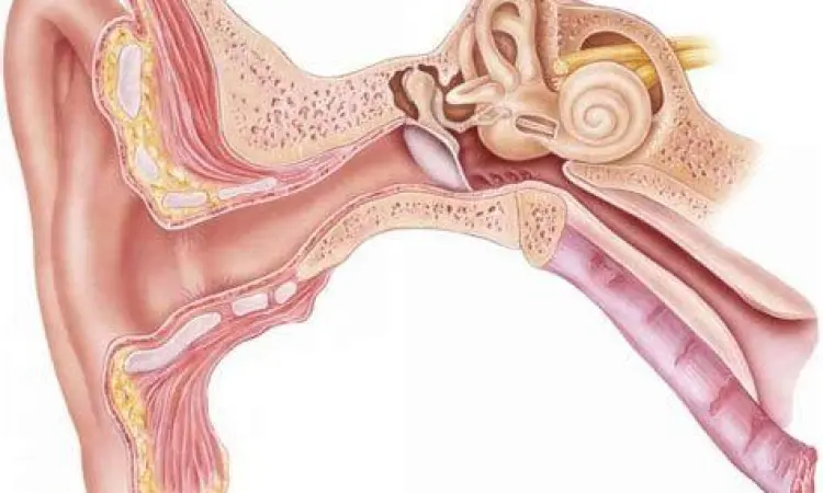 Anatomi telinga yang mengalami gangguan tinnitus