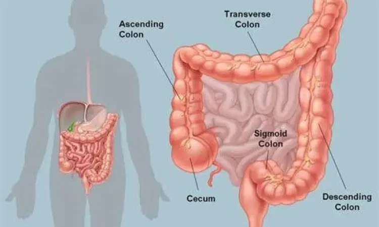 Anatomi Usus Besar Struktur anatomi usus besar meliputi sekum dan kolon