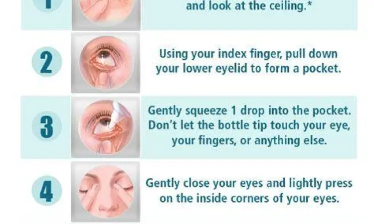 Cara mengaplikasikan salep mata dengan benar