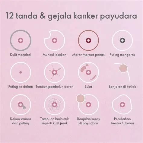 Gejala Visual Kanker Payudara Perubahan visual pada kulit payudara yang menunjukkan tanda keganasan