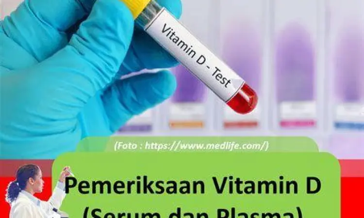 Prosedur cek darah kadar vitamin d