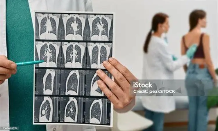 Hasil pemeriksaan CT Scan paru paru yang menunjukkan massa tumor