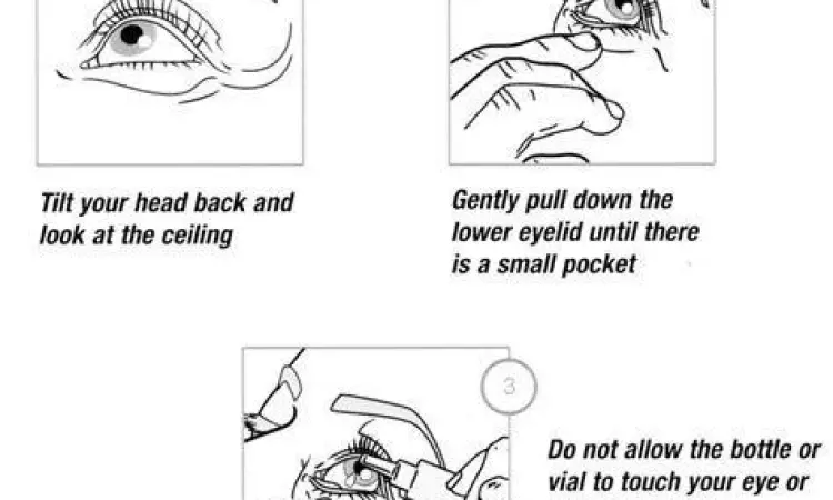 Cara mengoleskan salep mata yang benar