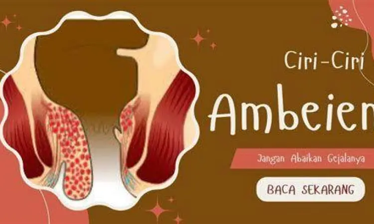 Visualisasi pembengkakan pembuluh darah pada ambeien ringan