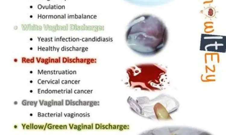 Tekstur keputihan putih susu yang normal