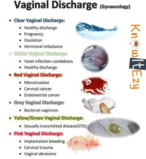 Keputihan Putih Susu Normal Tekstur keputihan putih susu yang normal