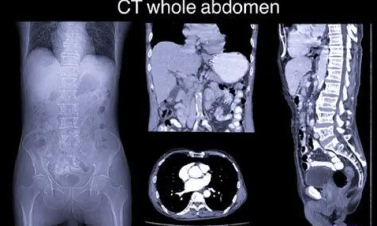 Hasil pemindaian CT scan pada bagian perut pasien