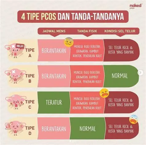 PCOS dan Gangguan Hormonal Ilustrasi ovarium penderita PCOS yang memicu keputihan coklat