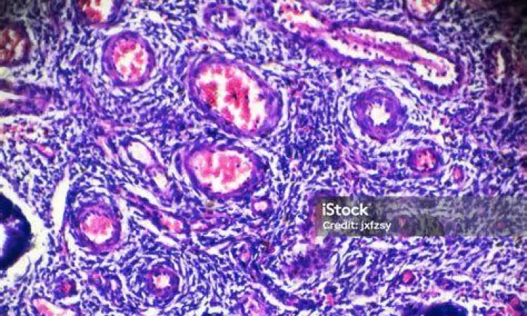Analisis Sel Serviks di Laboratorium Tampilan sel serviks abnormal di bawah mikroskop