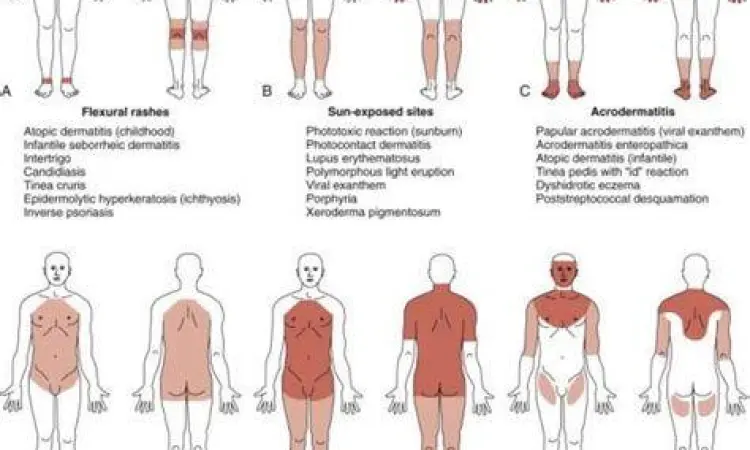 Pemeriksaan medis pada ruam kulit yang gatal