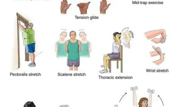 Latihan peregangan tangan untuk meredakan gejala carpal tunnel