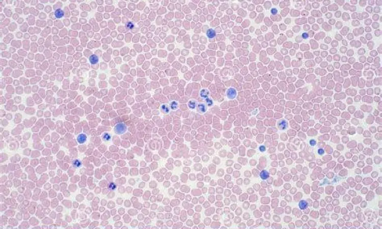 Sel darah merah tipe O di bawah mikroskop