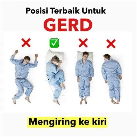 Posisi Tidur GERD Posisi tidur miring kiri untuk penderita asam lambung