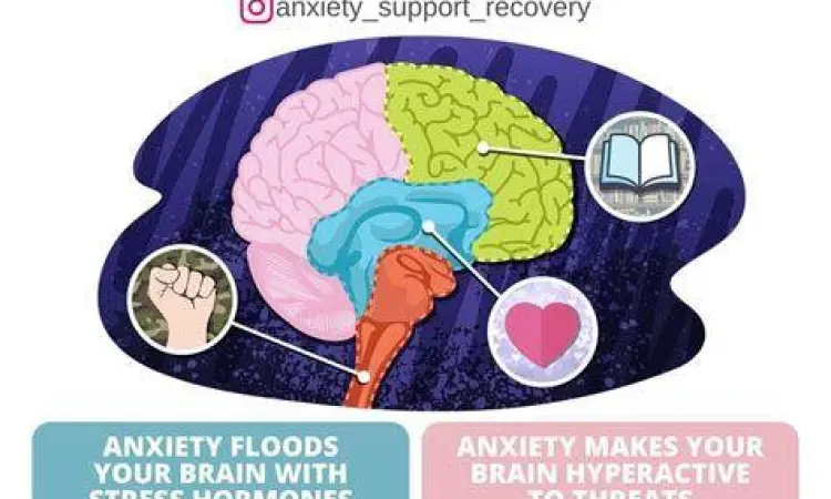 Aktivitas Otak dan Anxiety Visualisasi aktivitas otak saat mengalami anxiety