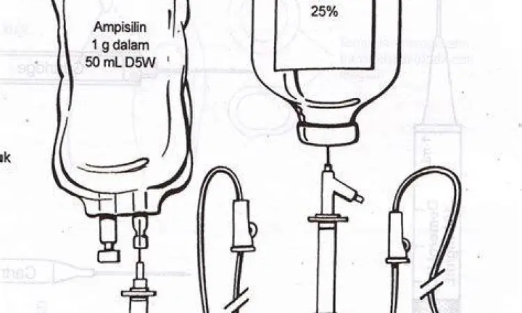 Prosedur Infus Intravena Petugas medis memasang infus di tangan pasien